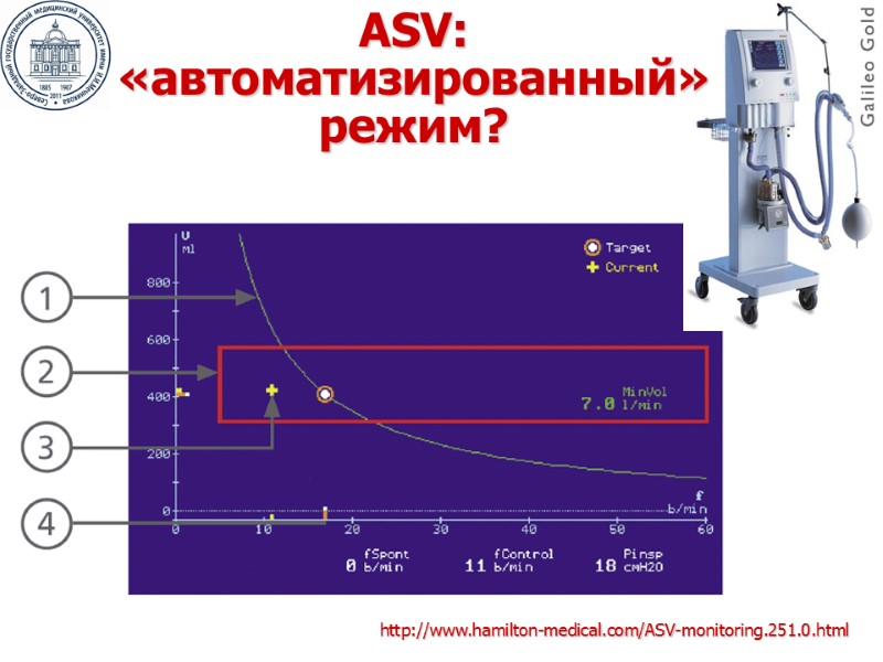 http://www.hamilton-medical.com/ASV-monitoring.251.0.html ASV:  «автоматизированный» режим?